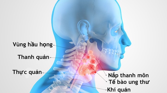 bai-viet/ung-thu-thanh-quan-giai-doan-cuoi-trieu-chung-cach-dieu-tri-va-cham-soc.html