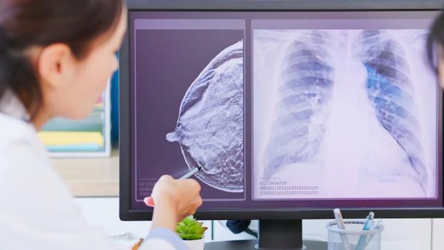 bai-viet/ung-thu-vu-luminal-a-kha-nang-dap-ung-voi-dieu-tri-va-tien-luong-song.html