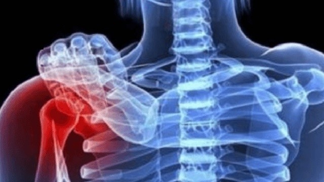 bai-viet/ung-thu-xuong-vai-la-benh-gi-cac-dau-hieu-nhan-biet-benh-ung-thu-xuong-vai.html