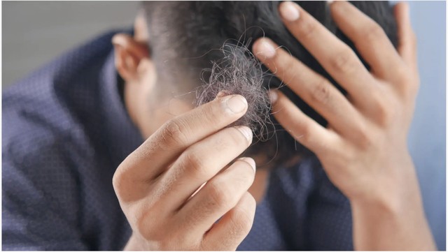 bai-viet/uong-creatine-gay-rung-toc-co-dung-hay-khong.html