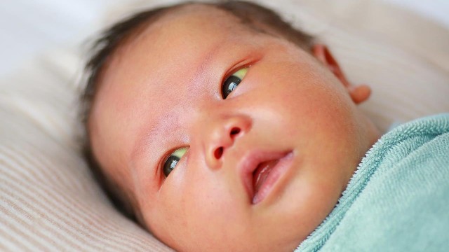 bai-viet/vang-da-sinh-li-va-vang-da-benh-ly-khac-nhau-nhu-the-nao.html