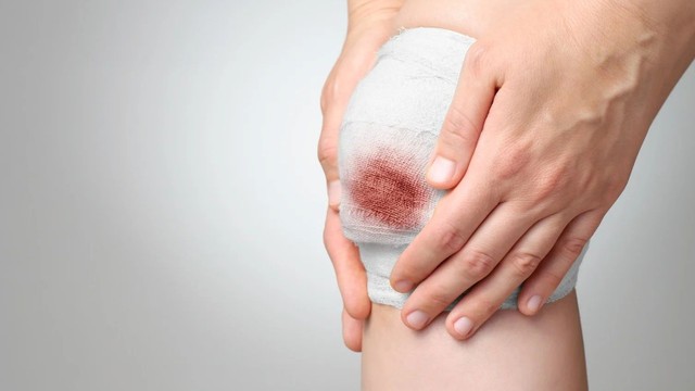 bai-viet/vet-thuong-ho-co-tu-lanh-duoc-khong-huong-dan-cham-soc-dung-cach.html