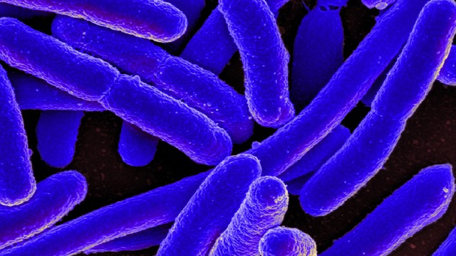 bai-viet/vi-khuan-e-coli-dac-diem-moi-truong-sinh-song-va-dau-hieu-nhan-biet-nhiem-trung.html