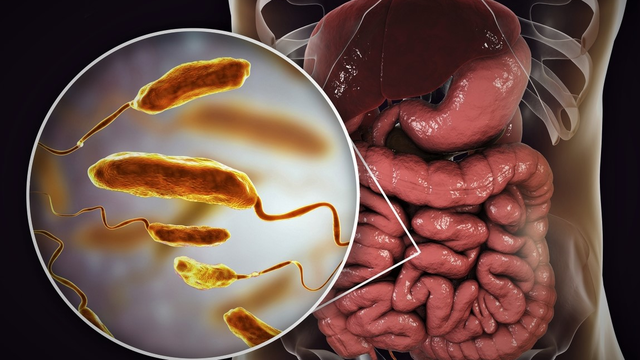 bai-viet/cac-trieu-chung-va-dau-hieu-khi-bi-nhiem-vi-khuan-ta.html