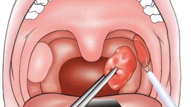 bai-viet/vi-sao-be-nao-va-xong-van-bi-so-mui-co-nguy-hiem-khong-56034.html