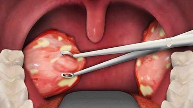 bai-viet/vi-sao-be-nao-va-xong-van-ngu-ngay-56033.html