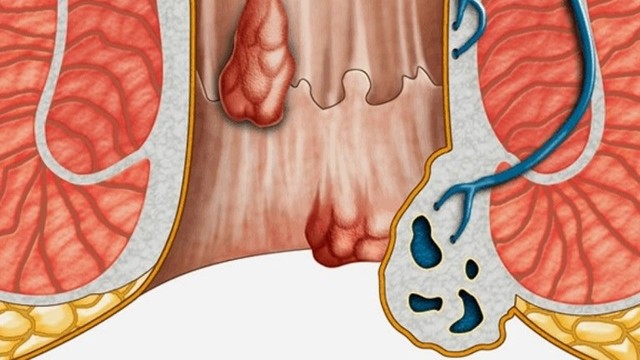 bai-viet/vi-sao-benh-nhan-cat-tri-xong-van-loi.html