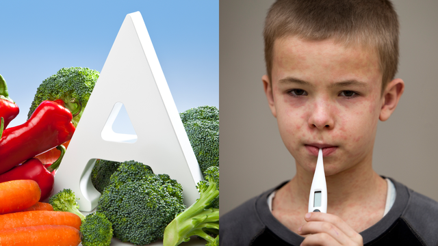 bai-viet/vi-sao-benh-nhan-mac-benh-soi-can-bo-sung-vitamin-a.html