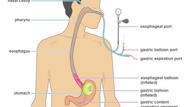 bai-viet/vi-sao-can-dat-ong-thong-da-day-cho-tre-so-sinh-cach-cham-soc-tre-khi-dat-ong.html