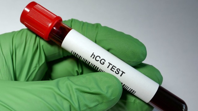 bai-viet/vi-sao-xet-nghiem-beta-hcg-am-tinh-nhung-van-co-thai.html