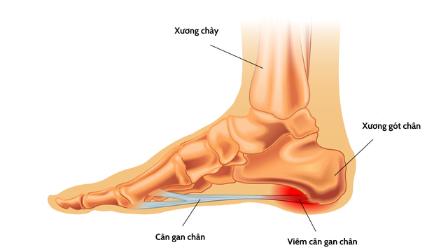 benh/viem-can-gan-chan.html