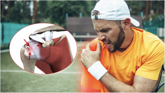 bai-viet/viem-chop-xoay-vai-nguyen-nhan-khien-vai-dau-dai-dang.html