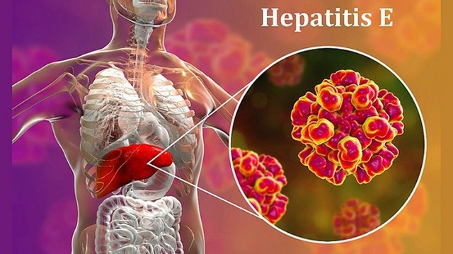 bai-viet/viem-gan-e-co-lay-qua-duong-mau-khong-hieu-ro-ve-cac-con-duong-lay-truyen-cua-benh.html