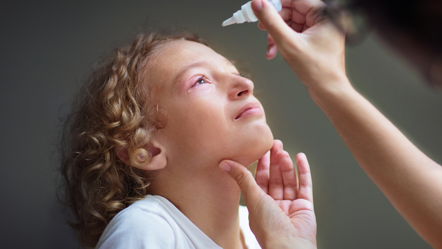 benh/viem-ket-mac-cap.html