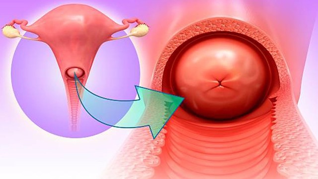 bai-viet/viem-lo-tuyen-5mm-la-cap-do-may-cach-dieu-tri-viem-lo-tuyen-la-gi.html