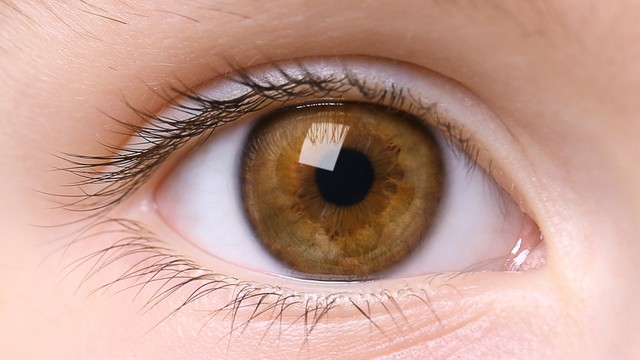 bai-viet/viem-loet-giac-mac-hinh-canh-cay-la-gi-cach-cham-soc-mat-trong-va-sau-dieu-tri.html