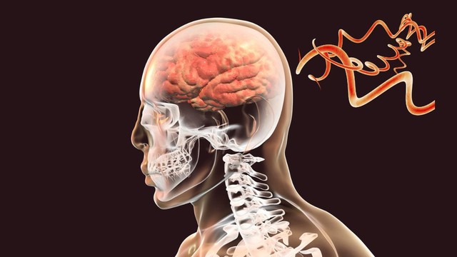 bai-viet/viem-mang-nao-do-giang-mai-muc-do-nguy-hiem-cach-nhan-biet-va-dieu-tri.html