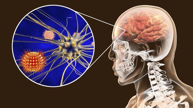 benh/viem-mang-nao-mu.html