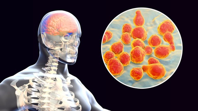 bai-viet/viem-mang-nao-va-viem-nao-nhat-ban-khac-nhau-the-nao.html