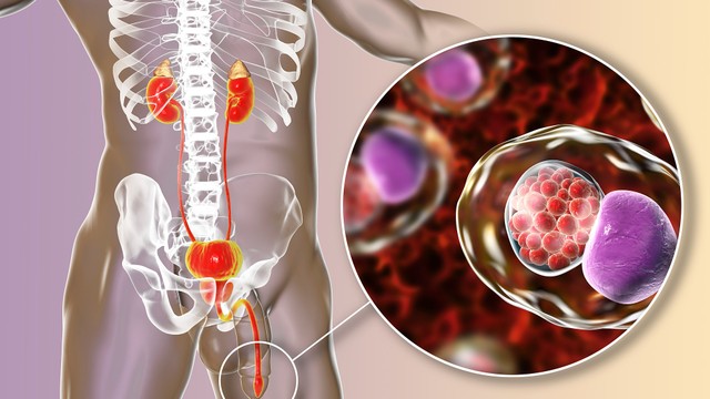 bai-viet/viem-nieu-dao-o-nam-gioi-nguyen-nhan-trieu-chung-va-cach-phong-ngua.html