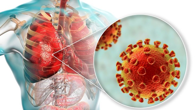 bai-viet/viem-phoi-cong-dong-va-viem-phoi-benh-vien-khac-nhau-nhu-the-nao.html