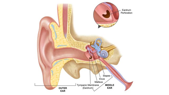 benh/viem-tai-giua-thung-mang-nhi.html