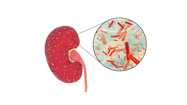 benh/viem-than-be-than.html