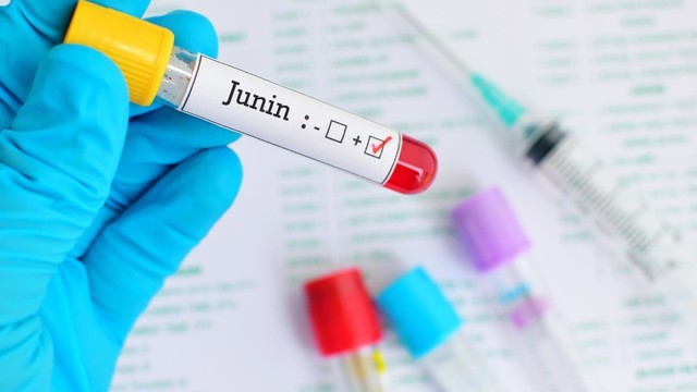 bai-viet/virus-junin-la-gi-dac-diem-cau-tao-cua-virus-junin.html