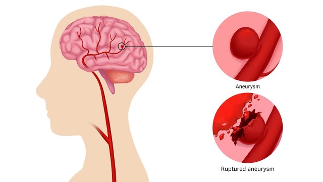 bai-viet/vo-mach-mau-nao-song-duoc-bao-lau.html