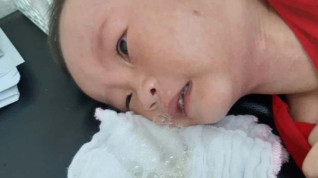 bai-viet/co-nen-tu-thuc-hien-vo-rung-long-dom-cho-tre-tai-nha-hay-khong-1.html