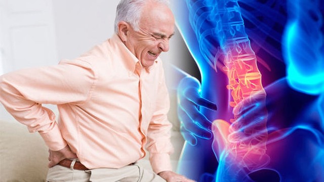 bai-viet/voi-hoa-cot-song-that-lung-nguyen-nhan-trieu-chung-va-cach-dieu-tri-hieu-qua.html