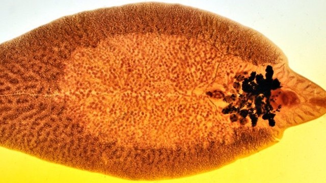 bai-viet/vong-doi-cua-san-la-gan-co-dac-diem-gi-trieu-chung-khi-nhiem-san-la-gan-65030.html