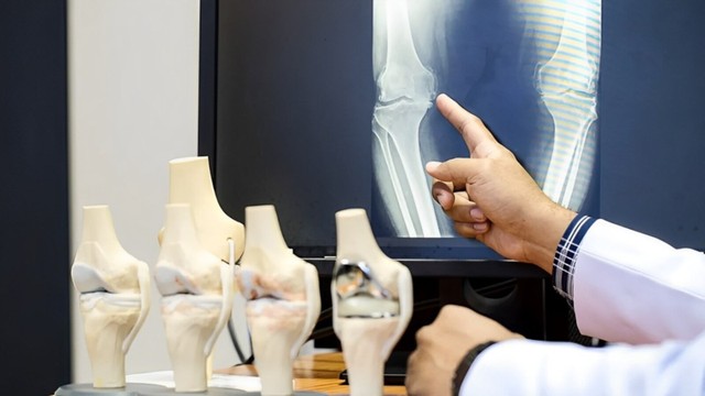 bai-viet/x-quang-thoai-hoa-khop-goi-tam-quan-trong-va-ung-dung-trong-chan-doan-y-khoa.html