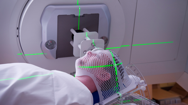 bai-viet/xa-tri-ung-thu-mau-la-gi-cac-phuong-phap-dieu-tri-ung-thu-mau.html