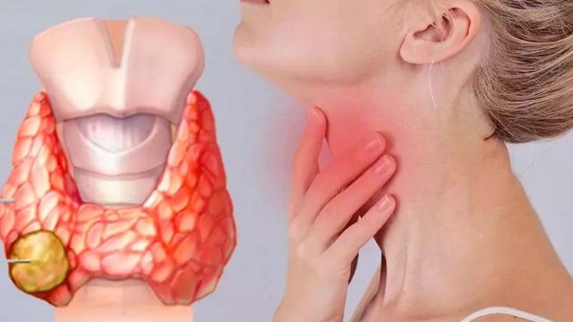 bai-viet/xa-tri-ung-thu-tuyen-giap-phuong-phap-dieu-tri-hieu-qua-va-nhung-dieu-can-biet.html