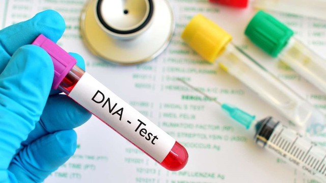 bai-viet/xet-nghiem-adn-bang-niem-mac-mieng-co-dung-khong-thuc-hien-nhu-the-nao.html