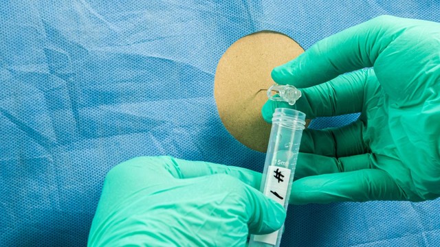 bai-viet/tim-hieu-chi-tiet-ve-phuong-phap-xet-nghiem-cay-dich-nao-tuy.html