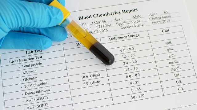 bai-viet/xet-nghiem-chuc-nang-gan-bao-nhieu-tien.html