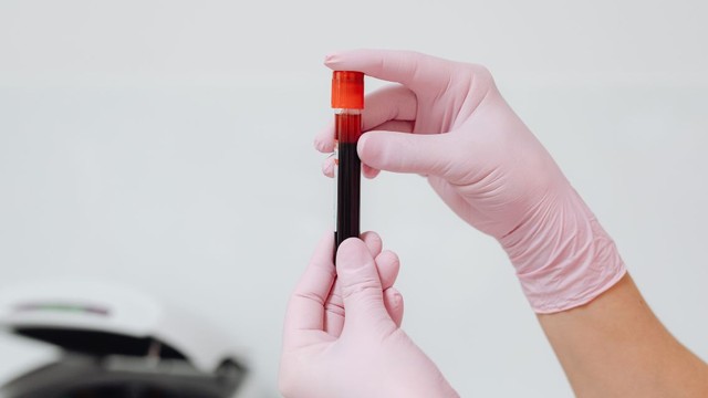 bai-viet/tim-hieu-chi-tiet-ve-xet-nghiem-cong-thuc-mau-18-thong-so.html