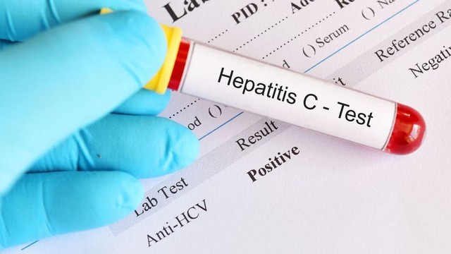 bai-viet/xet-nghiem-hcv-ab-la-gi-vai-tro-cua-hcv-ab-trong-chan-doan-benh-viem-gan.html