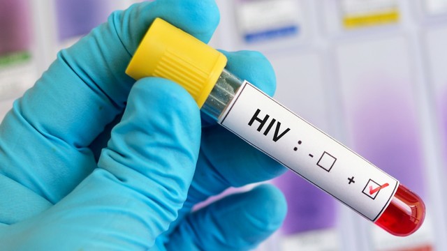 bai-viet/xet-nghiem-hiv-o-dau-tphcm-thoi-diem-nao-nen-thuc-hien-xet-nghiem.html