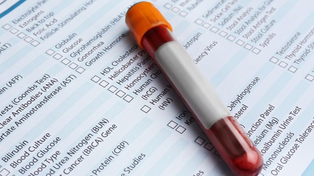 bai-viet/xet-nghiem-homocysteine-va-vai-tro-trong-phat-hien-benh-tim-mach.html