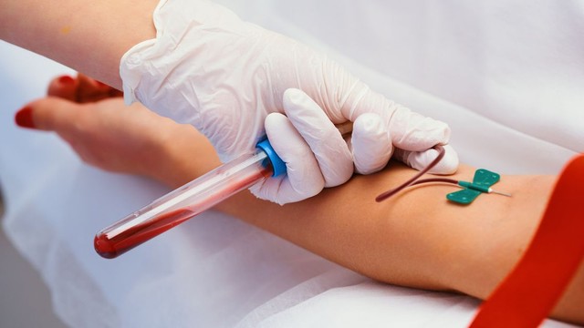 bai-viet/xet-nghiem-mau-co-can-nhin-an-khong-khi-nao-co-va-khi-nao-khong.html