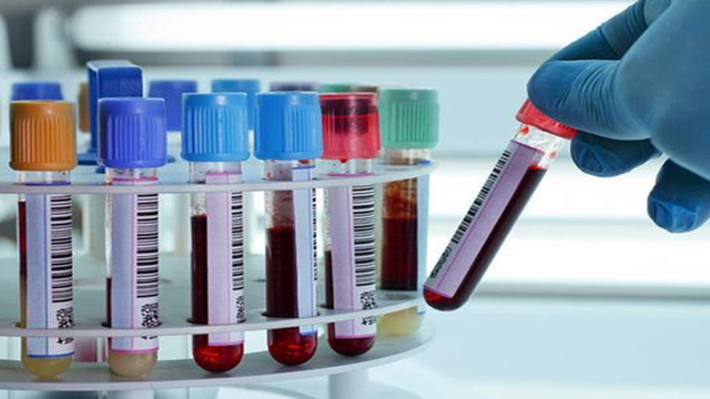 bai-viet/xet-nghiem-mau-co-phat-hien-nghien-ma-tuy-khong-66019.html