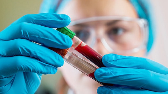 bai-viet/xet-nghiem-mau-phat-hien-ung-thu-som-co-dung-hay-khong.html