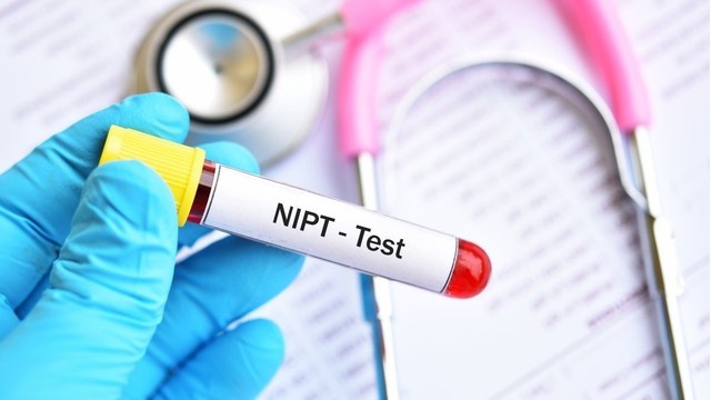 bai-viet/xet-nghiem-nipt-la-gi-nhung-dieu-can-biet-ve-xet-nghiem-nipt-60340.html