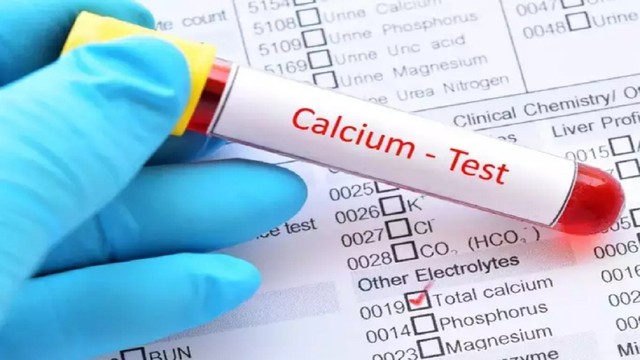 bai-viet/nhung-dieu-can-biet-ve-nong-do-canxi-trong-mau.html