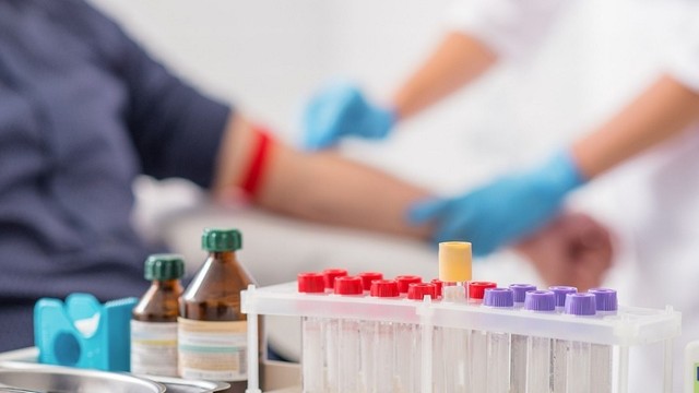 bai-viet/xet-nghiem-protein-la-gi-muc-dich-cua-viec-xet-nghiem-protein.html