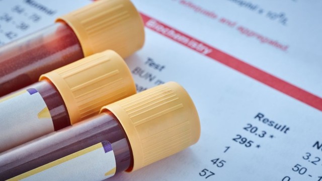 bai-viet/xet-nghiem-roi-loan-chuyen-hoa-bam-sinh-nhung-dieu-can-biet.html