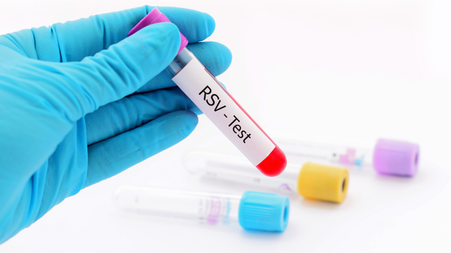 bai-viet/xet-nghiem-rsv-la-gi-chan-doan-va-dieu-tri-nhiem-virus-rsv.html